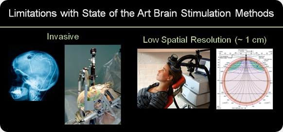 Stimulation-cerveau-DARPA
