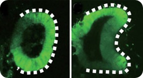 embryon-oeil-tube2