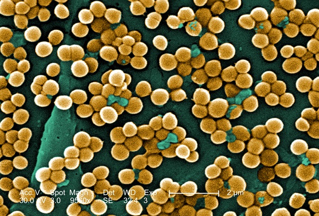 Stapholococcus aureus