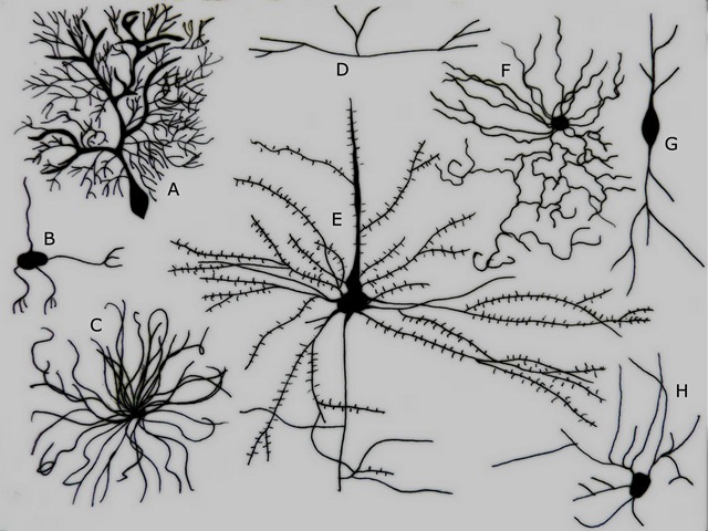 types-neurone-Golgi