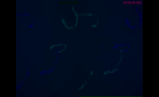 Caenorhabditis elegans-fluorescence-mort@GuruMeditation
