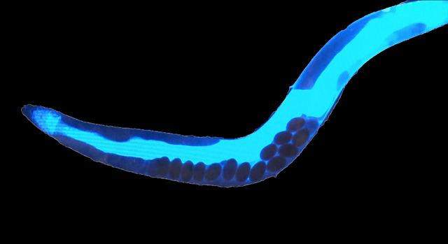 Caenorhabditis elegans-mort fluorescente1_clipped_rev_1