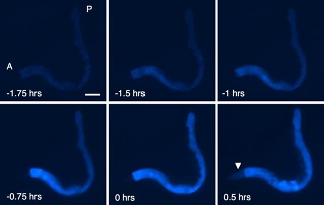Caenorhabditis elegans-mort fluorescente