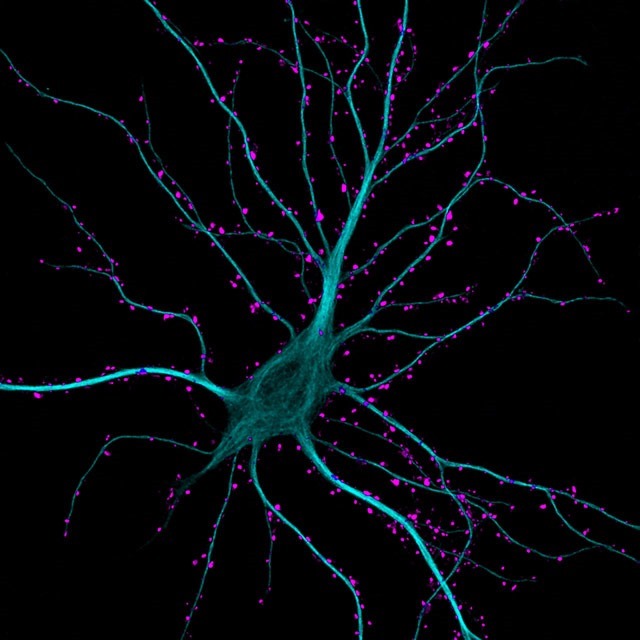5_K-Boyle-neurone-hippocampal