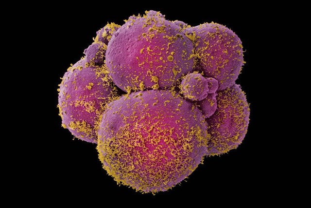 embryon-humain2