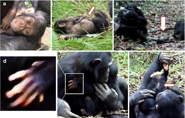 Chimpanzé-trisomie