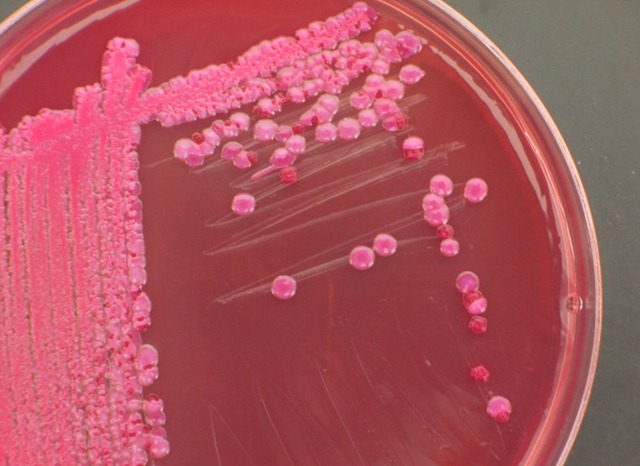 Escherichia coli Enterobacter
