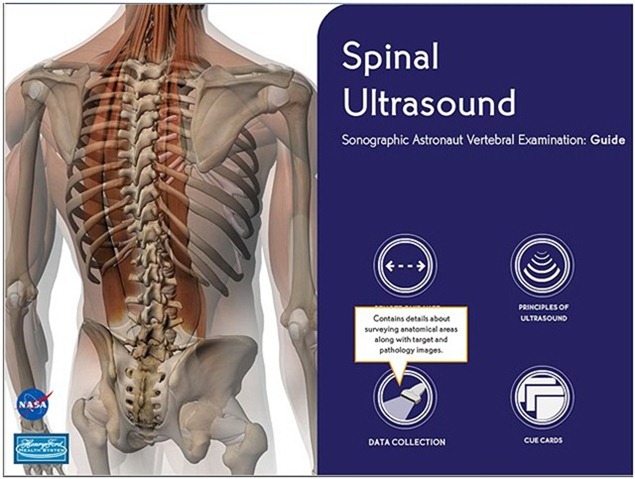 NASA-Spinal-Ultrasound