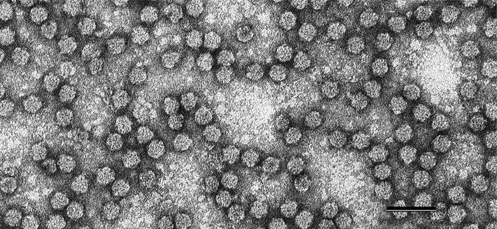 nanovirus