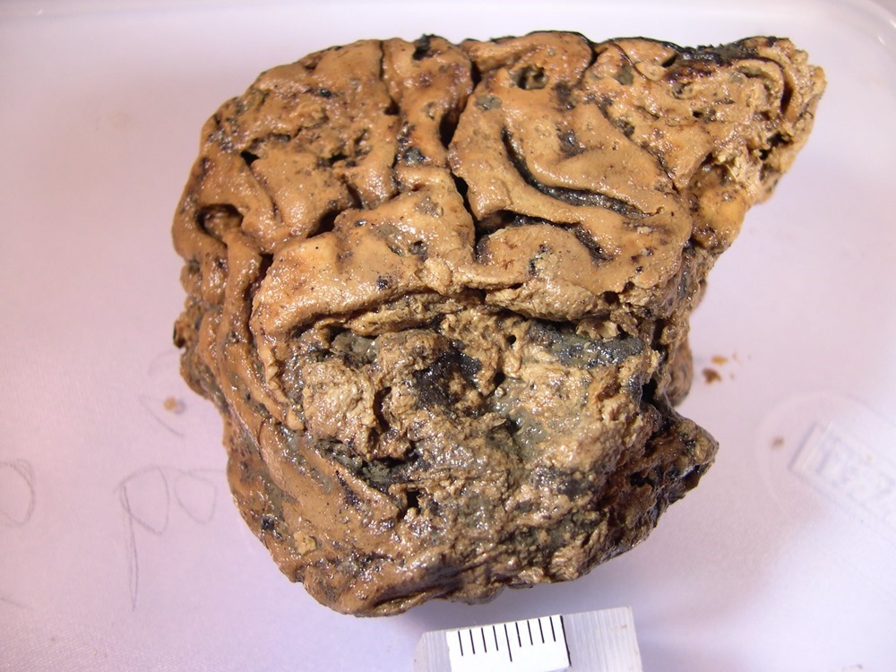 cerveau de Heslington 3 20