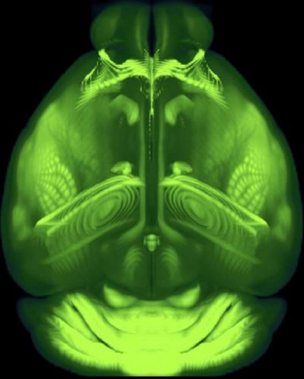 Человек мышь мозг. Зеленая кт. Мозг мухи.