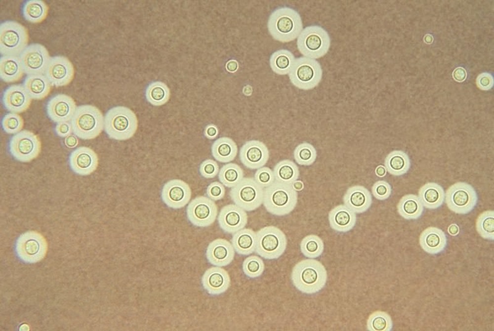 Cryptococcus neoformans 1 20