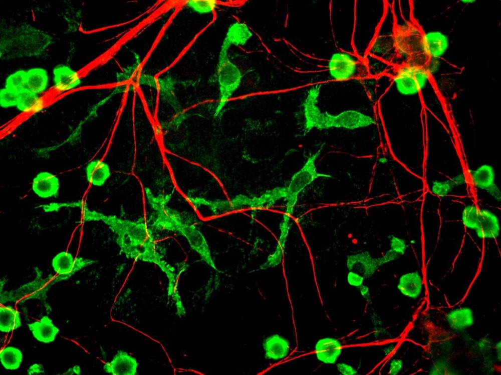 Microglia_Neurones 1 20