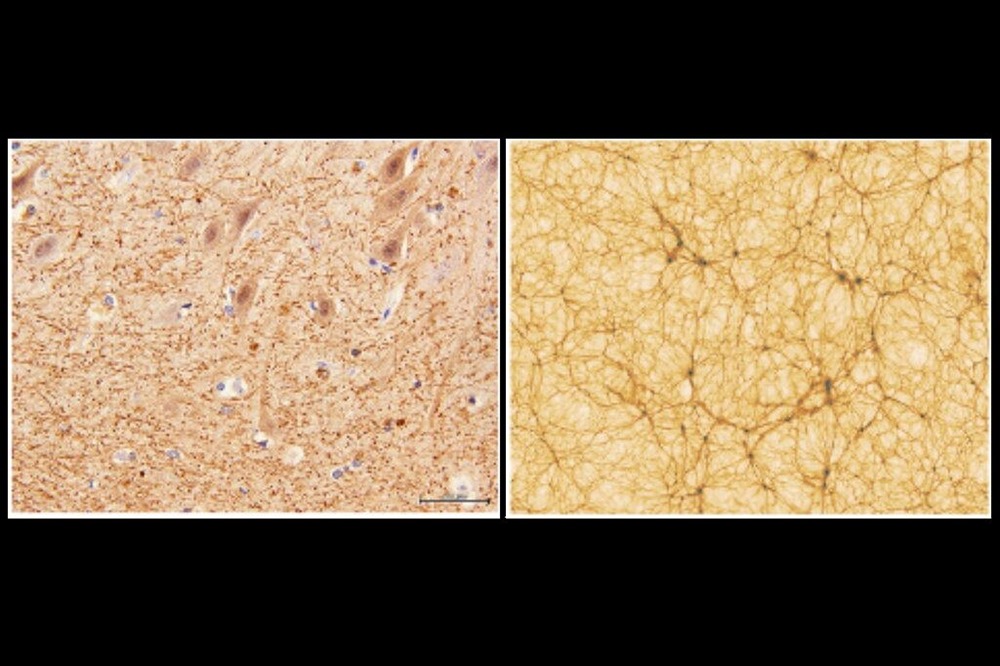 Comparaison réseaux galaxies Cerveau 1 20