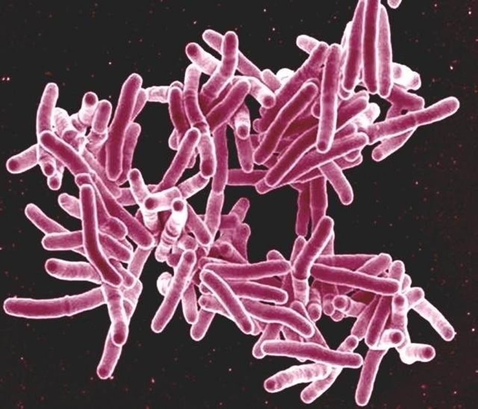 Mycobacterium tuberculosis 1 20