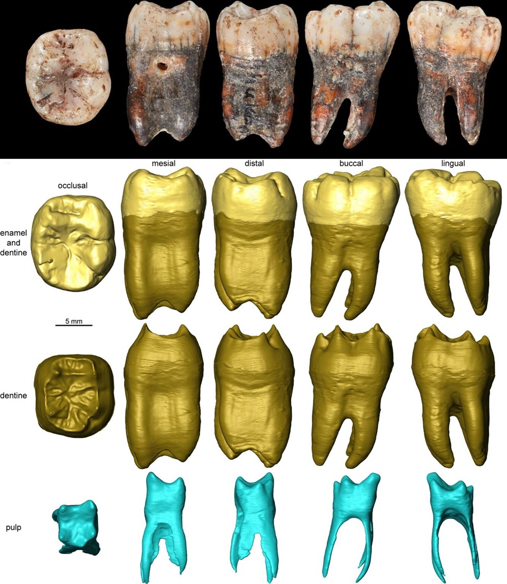 Dent enfant neanderthals 1 21