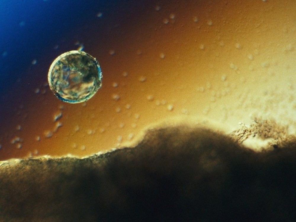 blastocyste 1 21