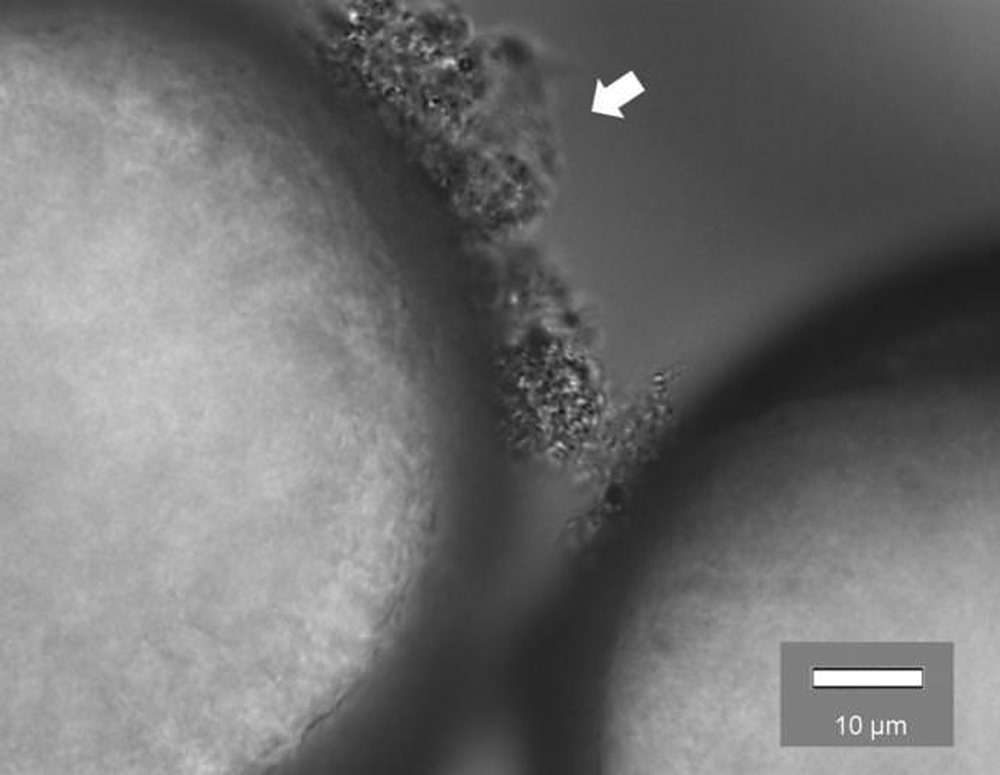 microplastique superbactérie 2 21