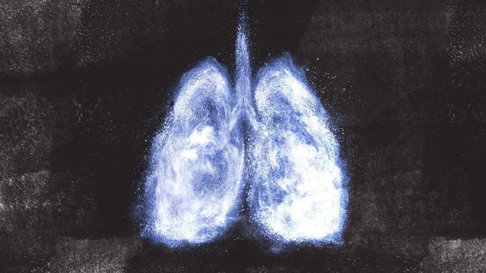 Asthme - tumeur 1 21