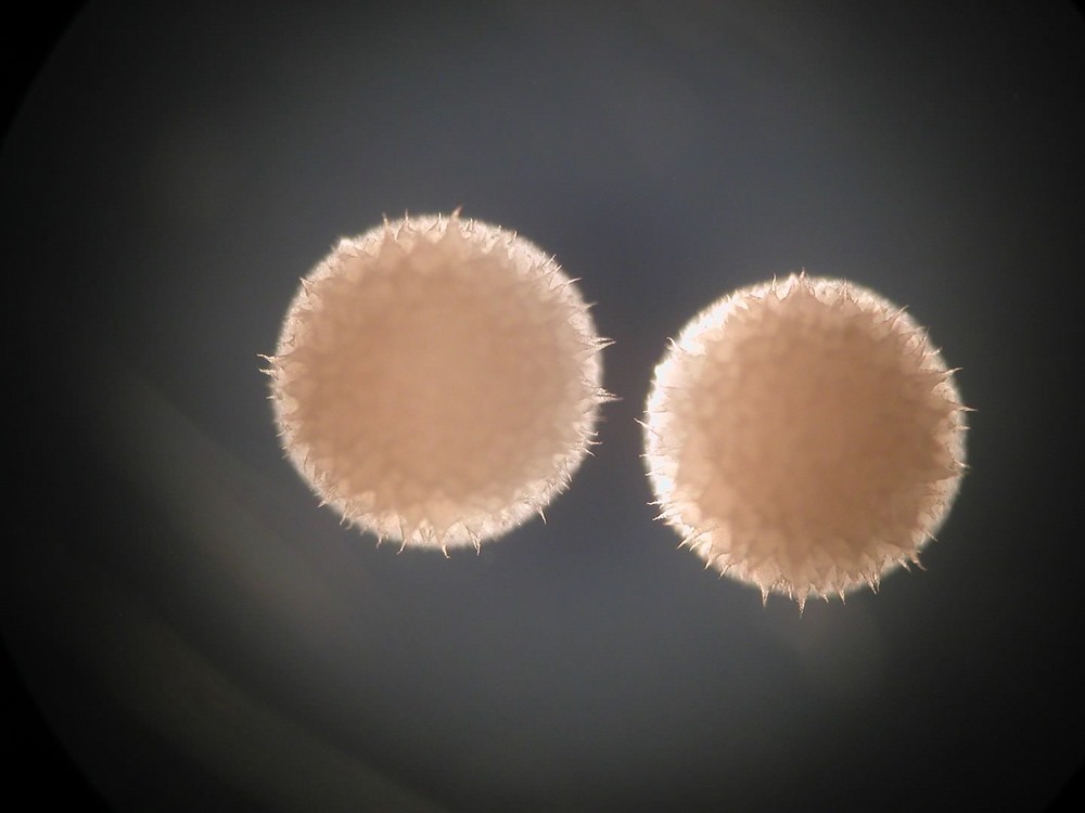 Streptomyces_hygroscopicus 1 22