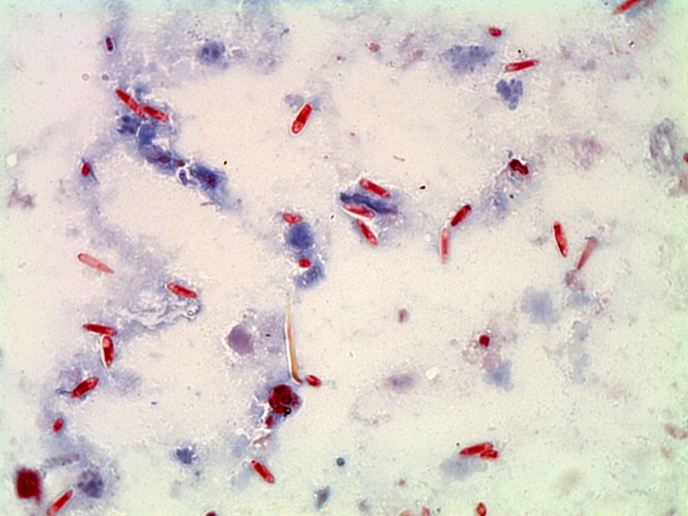 Spores de microsporidies 1 22