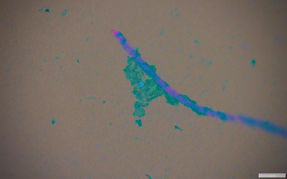 Microplastique pathogène 2 22