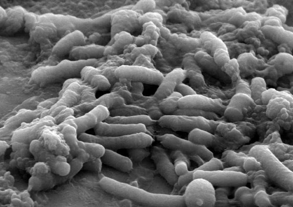 bacteries E coli intestinales 1 22