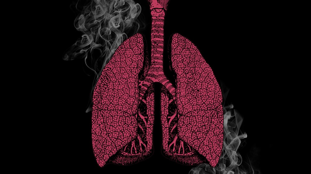 Cancer poumon fumeur 1 22