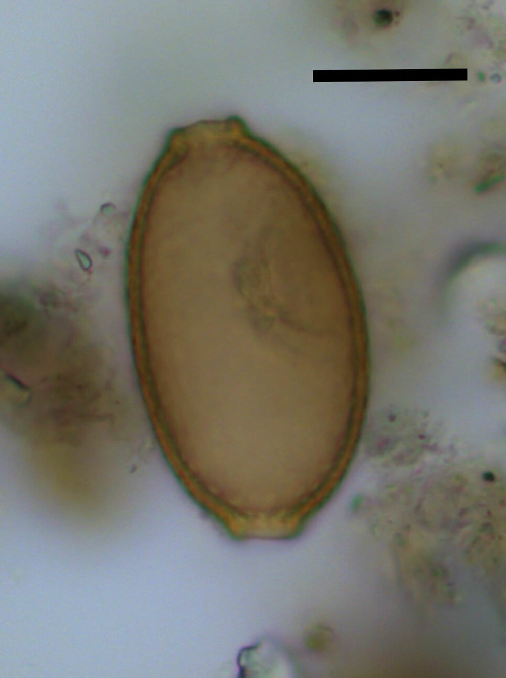 Coprolithe parasite Stonedge 1 22
