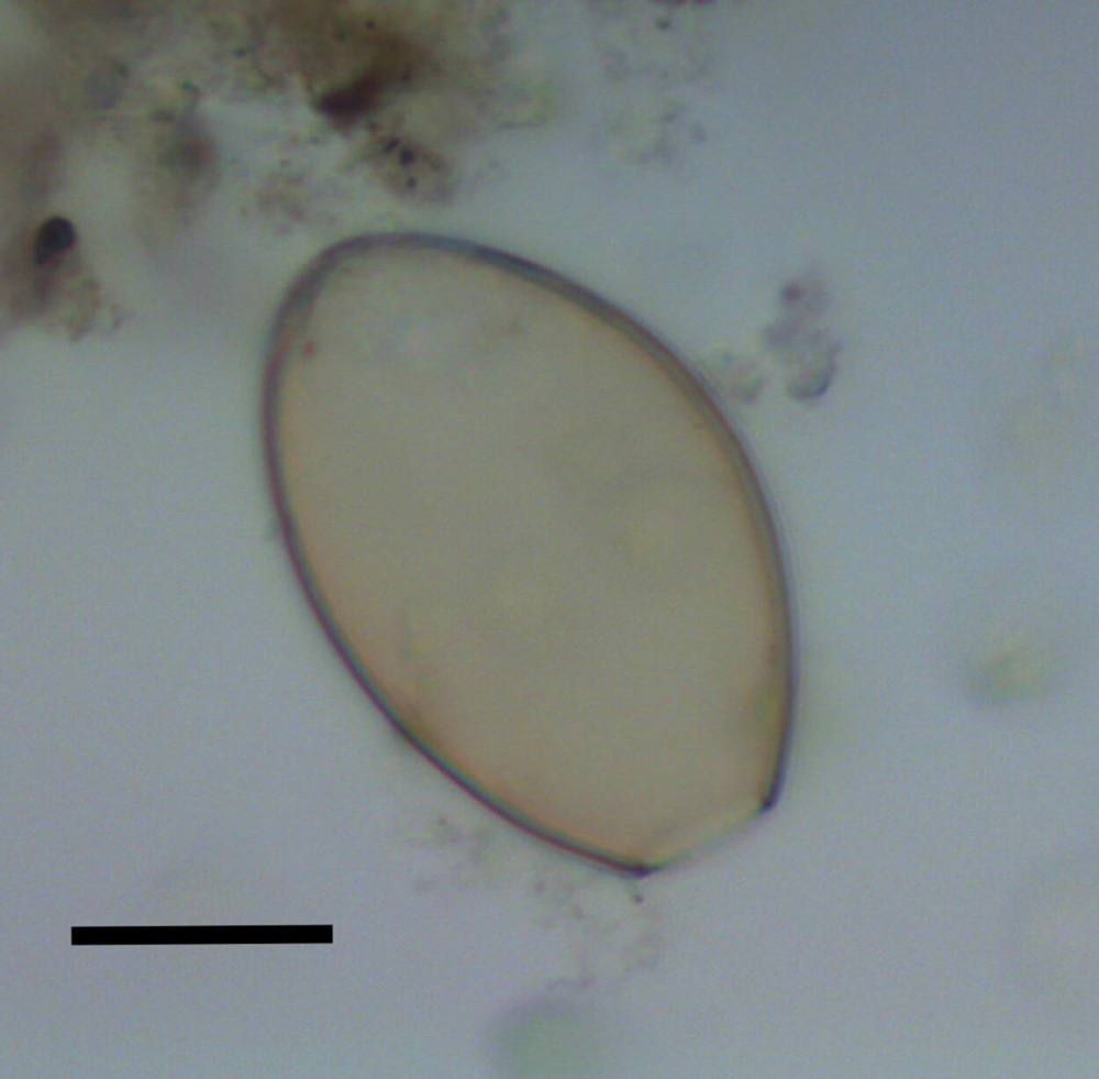 Coprolithe parasite Stonedge 3 22