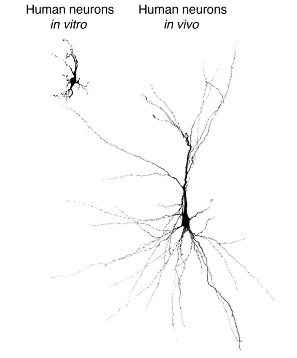 organoïdes neuronaux rat - Humain 1 22