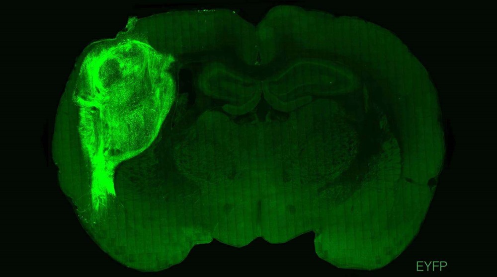 organoïdes neuronaux rat - Humain 3 22
