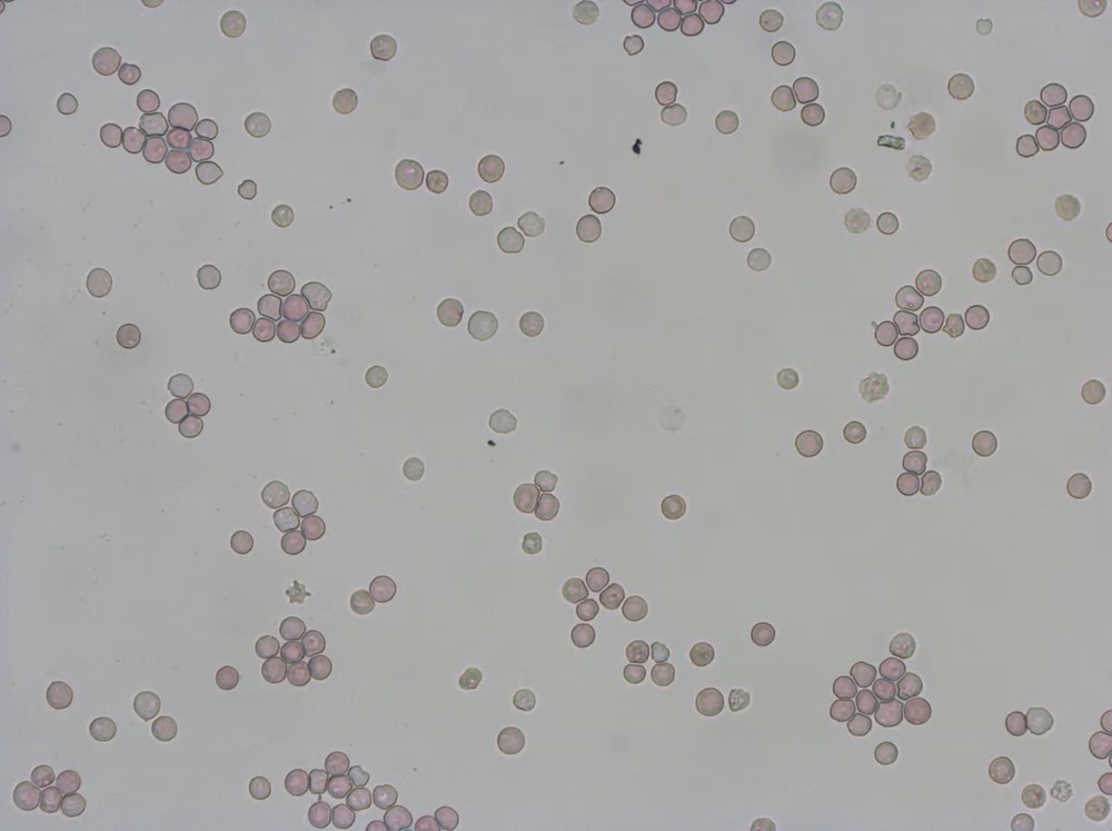 Transfusion cellules cultivées 2 22