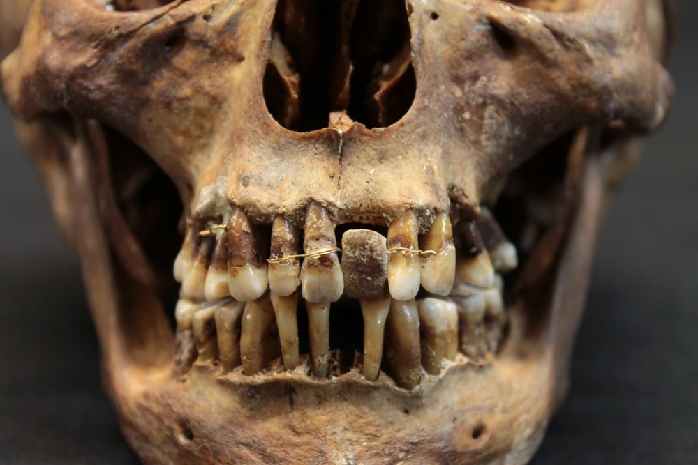 dentition Anne-dalegre 1 23