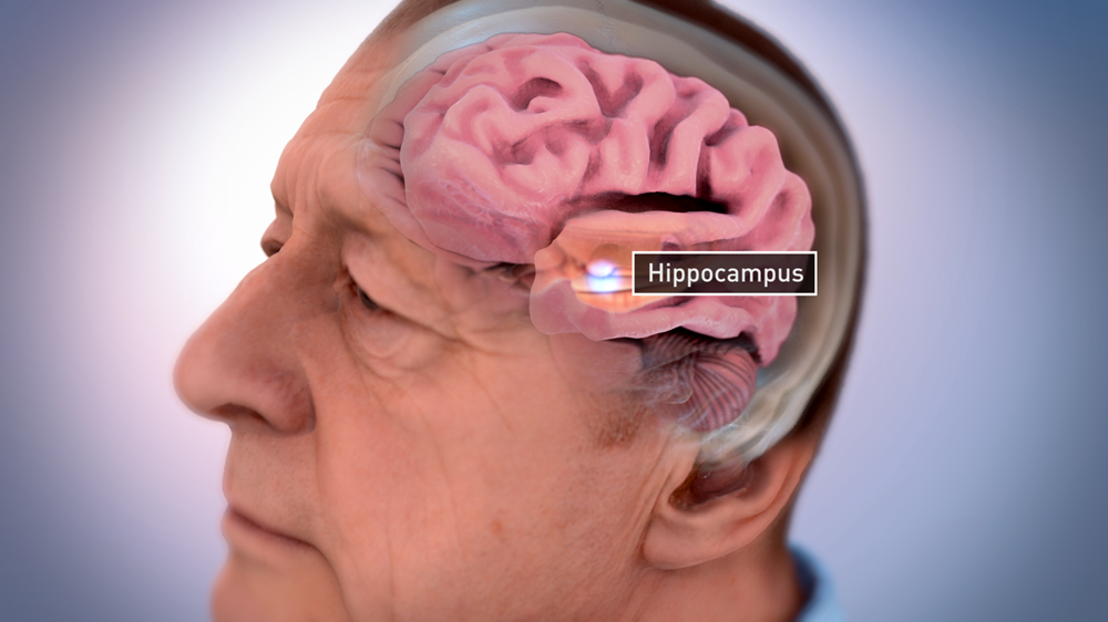 hippocampus-brain-shrinkage
