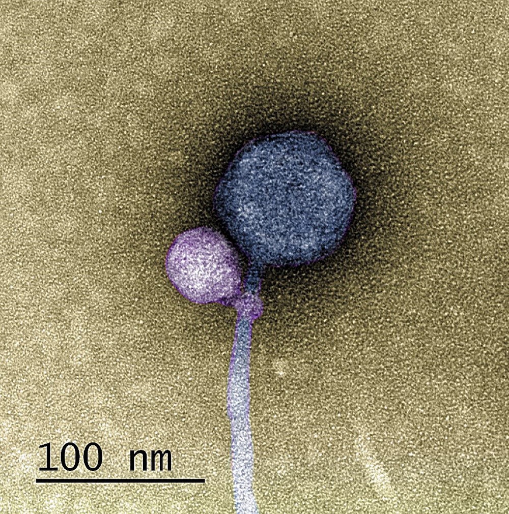 Virus auxiliaire-satellit attache 1 23
