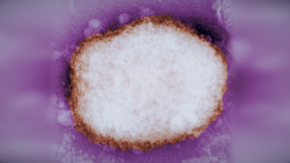 mpox variole du singe 1 23