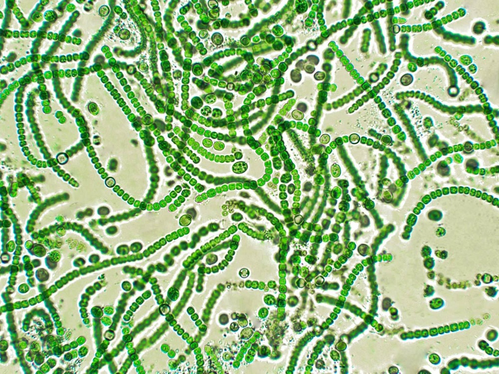 Cyanobacteria 1 24